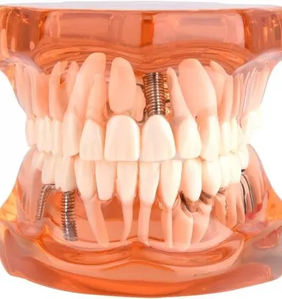 Dental Disease Removable Teaching Teeth Model