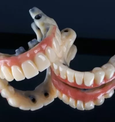 Test Denture from Anita Lab